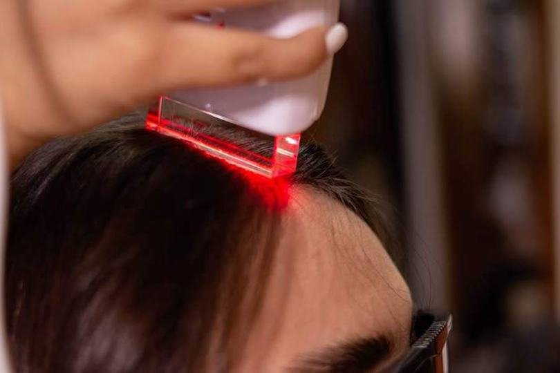 Laserterapia capilar
